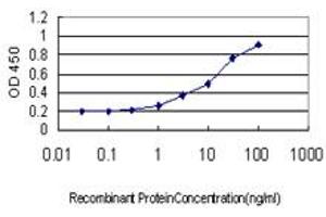 Detection limit for recombinant GST tagged USP47 is approximately 0. (USP47 antibody  (AA 203-301))