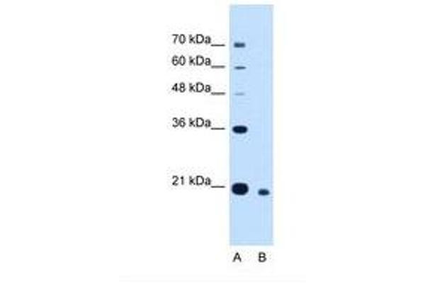 CDCA4 antibody  (N-Term)