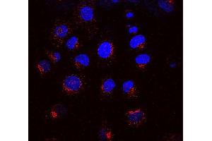 Immunocytochemistry/Immunofluorescence analysis using Mouse Anti-KDEL Receptor Monoclonal Antibody, Clone KR-10 .
