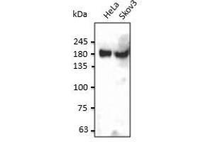Endogenous INSR detected at 1/2,500 dilution, Iysate at 50 µg per Iane and rabbit polyclonal to goat lgG (HRP) at 1/10,000 dilution. (Insulin Receptor antibody  (C-Term))