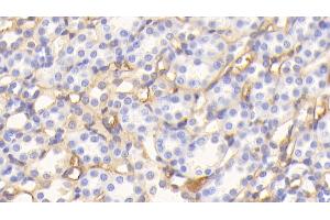 Detection of ALB in Rat Kidney Tissue using Polyclonal Antibody to Albumin (ALB) (Albumin antibody)