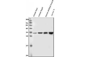 Western blot analysis of VAPB using anti-VAPB antibody (ABIN5693292). (VAPB antibody  (AA 2-55))