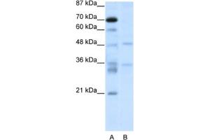 Western Blotting (WB) image for anti-Forkhead Box N2 (FOXN2) antibody (ABIN2461649) (FOXN2 antibody)
