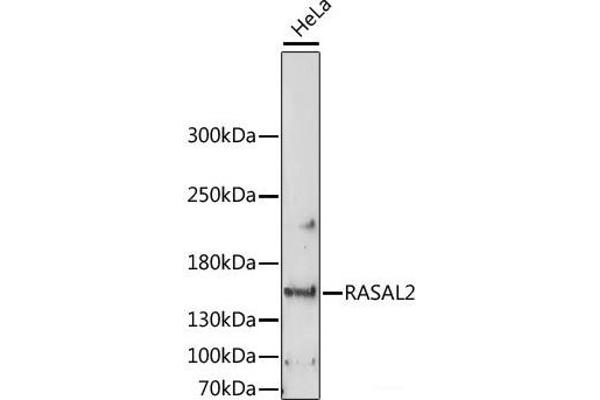 RASAL2 抗体