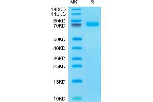 Human BCAM on Tris-Bis PAGE under reduced condition. (BCAM Protein (AA 32-547) (His tag))