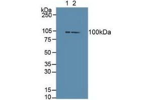 Western blot analysis of (1) Mouse Brain Tissue and (2) Mouse Liver Tissue. (DVL3 antibody  (AA 545-716))