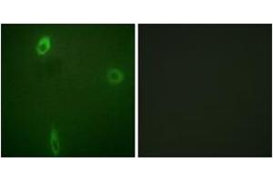 Immunofluorescence analysis of A549 cells, using ROMK/Kir1. (KCNJ1 antibody  (pSer44))