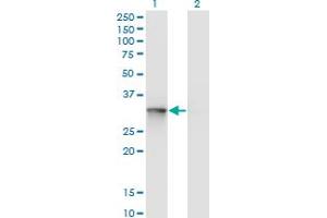 Western Blot analysis of UBE2R2 expression in transfected 293T cell line by UBE2R2 monoclonal antibody (M01), clone 5E7. (UBE2R2 antibody  (AA 1-238))