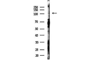 Western blot analysis of lysates from EC304 cells(starvation 24h treatment), using DDX58 Antibody at 1/1000 dilution.