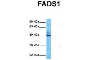 Host:  Rabbit  Target Name:  FADS1  Sample Tissue:  Human Fetal Liver  Antibody Dilution:  1. (FADS1 antibody  (C-Term))