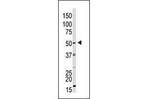 The anti-GDF9 N-term Pab (ABIN388822 and ABIN2839140) is used in Western blot to detect GDF9 in HL60 cell lysate. (GDF9 antibody  (N-Term))