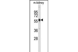 Western blot analysis of Park6 (PINK1) C-term (ABIN652208 and ABIN2840776) in mouse kidney tissue lysates (35 μg/lane). (PINK1 antibody  (C-Term))