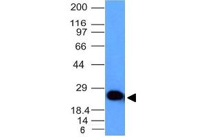 Western Blot Analysis of human Brain lysate using Pgp9. (UCHL1 antibody)