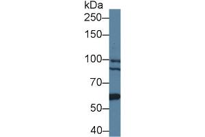 Western blot analysis of Human 293T cell lysate, using Mouse BCOR Antibody (1 µg/ml) and HRP-conjugated Goat Anti-Rabbit antibody ( (BCOR antibody  (AA 1553-1755))