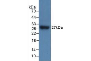 Detection of Recombinant IL17RC, Mouse using Polyclonal Antibody to Interleukin 17 Receptor C (IL17RC) (IL17RC antibody  (AA 73-330))