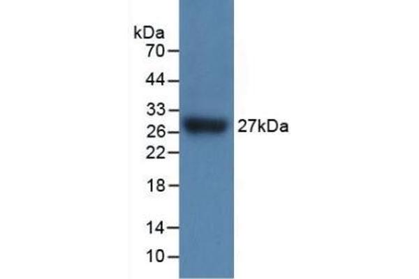 IL17RC antibody  (AA 73-330)