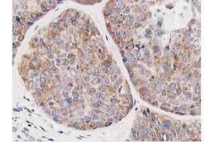 Immunohistochemistry (IHC) image for anti-Leucine Carboxyl Methyltransferase 1 (LCMT1) antibody (ABIN1499107) (LCMT1 antibody)
