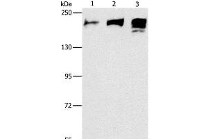 Western Blot analysis of Human ileum adenocarcinoma tissue, Human testis and prostate tissue using ACE1 Polyclonal Antibody at dilution of 1:240 (Angiotensin I Converting Enzyme 1 antibody)