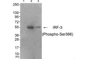Western blot analysis of extracts from 293 cells (Lane 2) and colo cells (Lane 3), using IRF-3 (Phospho-Ser386) Antibody. (IRF3 antibody  (pSer386))