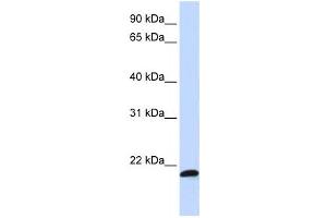 Western Blotting (WB) image for anti-Chromosome 21 Open Reading Frame 56 (C21orf56) antibody (ABIN2458971) (C21ORF56 antibody)