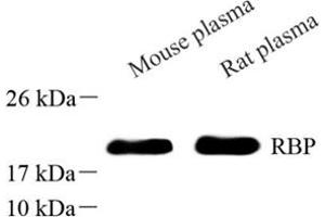 Western blot analysis of RBP (ABIN7075409) at dilution of 1: 500