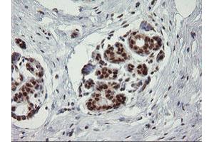 Image no. 2 for anti-tRNA Methyltransferase 2 Homolog A (TRMT2A) antibody (ABIN1501516) (TRMT2A antibody)