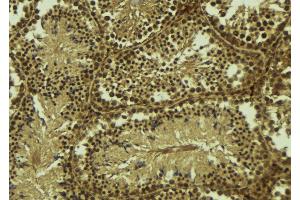 ABIN6277682 at 1/100 staining Mouse testis tissue by IHC-P. (PIAS2 antibody  (N-Term))