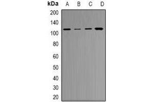 Western blot analysis of RB1 expression in A549 (A), NIH3T3 (B), K562 (C), PC12 (D) whole cell lysates. (Retinoblastoma 1 antibody)