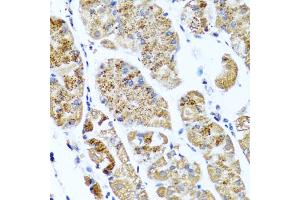 Immunohistochemistry of paraffin-embedded human stomach using COL10A1 antibody (ABIN5974149) at dilution of 1/100 (40x lens). (COL10A1 antibody)