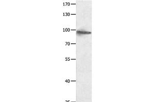 Western Blot analysis of Hela cell using HCN1 Polyclonal Antibody at dilution of 1:950 (HCN1 antibody)