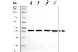 Western blot analysis of RPLP0 using anti-RPLP0 antibody (ABIN7599197).