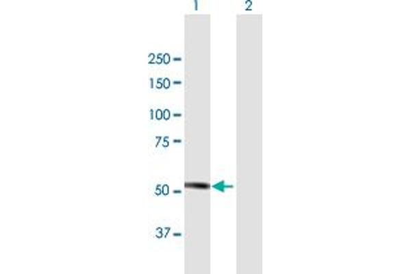 MKKS antibody  (AA 1-570)