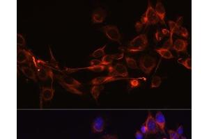Immunofluorescence analysis of NIH-3T3 cells using DKK3 Polyclonal Antibody at dilution of 1:100 (40x lens).
