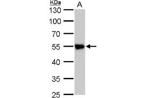 WB Image beta Tubulin 2 antibody detects beta Tubulin 2 protein by western blot analysis. (TUBB2A antibody)