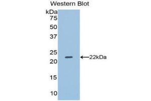 Western Blotting (WB) image for anti-Dual Specificity Phosphatase 3 (DUSP3) (AA 2-185) antibody (ABIN3201776) (Dual Specificity Phosphatase 3 (DUSP3) (AA 2-185) antibody)