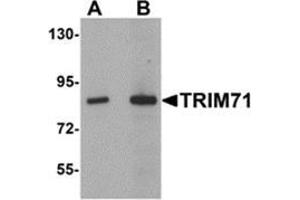 Western blot analysis of TRIM71 in human brain tissue lysate with TRIM71 antibody at (A) 1 and (B) 2 μg/ml.