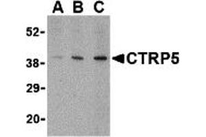 Western Blotting (WB) image for anti-C1q and Tumor Necrosis Factor Related Protein 5 (C1QTNF5) (Middle Region) antibody (ABIN1030914) (CTRP5 antibody  (Middle Region))