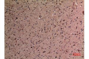 Immunohistochemistry (IHC) analysis of paraffin-embedded Mouse Brain, antibody was diluted at 1:100.