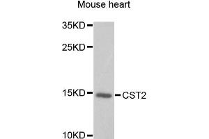 Western blot analysis of extracts of mouse heart, using CST2 antibody. (CST2 antibody)