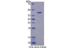 SDS-PAGE (SDS) image for Serine Palmitoyltransferase, Long Chain Base Subunit 3 (SPTLC3) (AA 238-552) protein (His tag) (ABIN6237534) (SPTLC3 Protein (AA 238-552) (His tag))