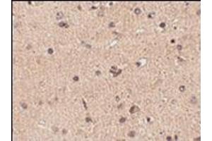 Immunohistochemistry of Slitrk2 in human brain tissue with this product at 2. (SLITRK2 antibody  (C-Term))