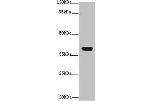 Western blot All lanes: Interleukin-12 subunit beta antibody at 14 μg/mL + K562 whole cell lysate Secondary Goat polyclonal to rabbit IgG at 1/10000 dilution Predicted band size: 37 kDa Observed band size: 37 kDa (IL12B antibody  (AA 23-327))