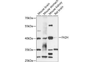 Western blot analysis of extracts of various cell lines, using FH antibody (ABIN6130395, ABIN6140411, ABIN6140413 and ABIN6218027) at 1:3000 dilution. (FA2H antibody  (AA 95-170))