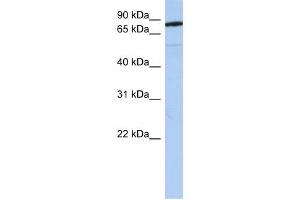 SEMA4B antibody used at 1 ug/ml to detect target protein. (SEMA4B antibody  (N-Term))