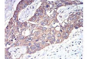 Immunohistochemistry (IHC) image for anti-RAB1B, Member RAS Oncogene Family (RAB1B) (AA 60-201) antibody (ABIN5875927) (RAB1B antibody  (AA 60-201))