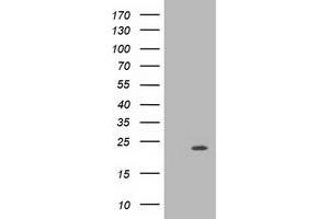 HEK293T cells were transfected with the pCMV6-ENTRY control (Left lane) or pCMV6-ENTRY MRAS (Right lane) cDNA for 48 hrs and lysed. (MRAS antibody)
