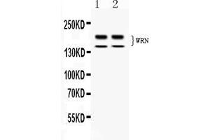 Western blot analysis of WRN expression in rat thymus extract ( Lane 1) and human placenta extract ( Lane 2). (RECQL2 antibody  (AA 122-240))