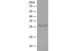 STAP1 Protein (AA 1-295) (His tag)