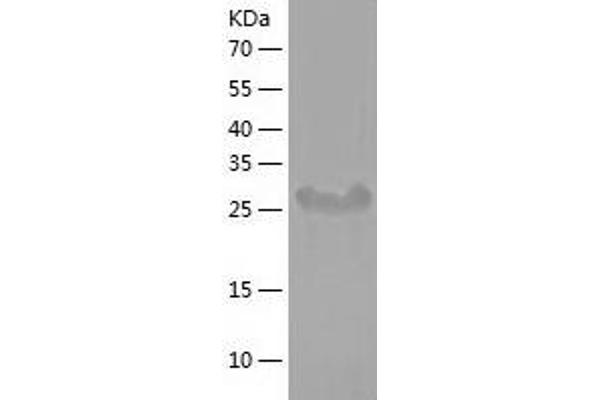 STAP1 Protein (AA 1-295) (His tag)