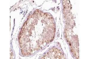 ABIN6266666 at 1/100 staining human testis tissue sections by IHC-P. (TUBG1 antibody  (N-Term))